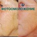 Услуги косметолога в Коломне